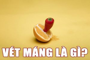 vét máng là gì?