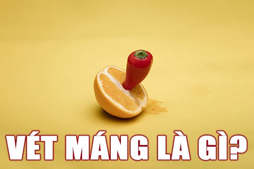 vét máng là gì?