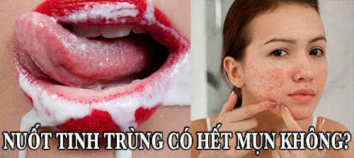 Tìm hiểu thắc mắc nuốt tinh trùng có hết mụn không